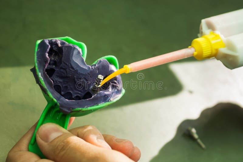 Zahnmedizinischer Eindruck stockbild Zahnmedizinischer Eindruck stockbild