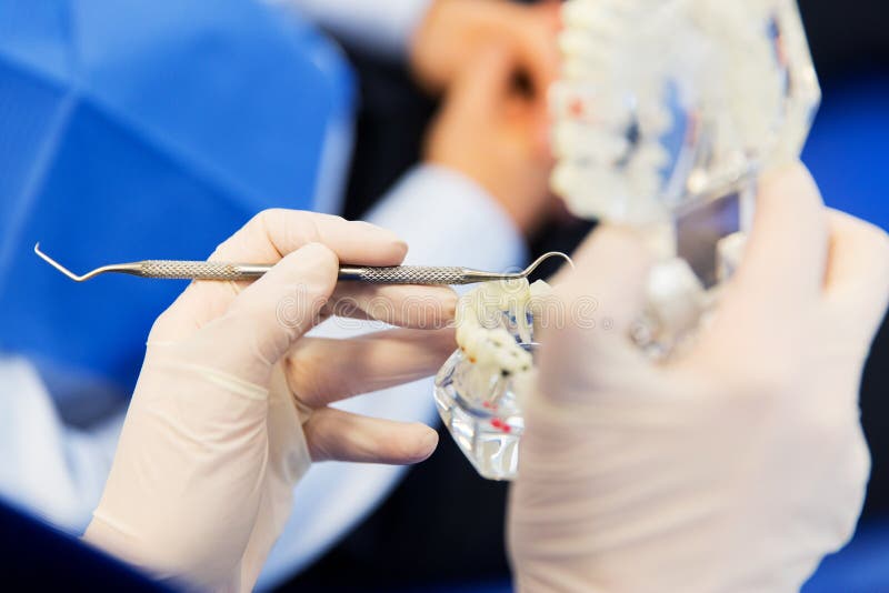 Zakończenie up dentysta z zębami i stomatologiczną sondą fotografia stock Zakończenie up dentysta z zębami i stomatologiczną sondą fotografia stock