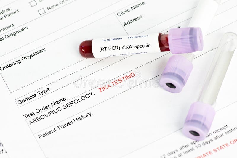 Zika-Virus-Laborversuch stockfotos Zika-Virus-Laborversuch stockfotos