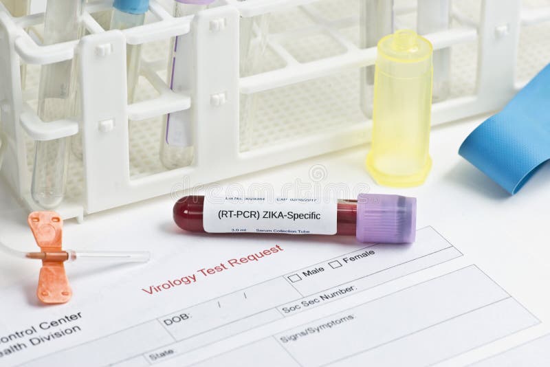 Zika-Virus-Laborversuch stockfoto Zika-Virus-Laborversuch stockfoto
