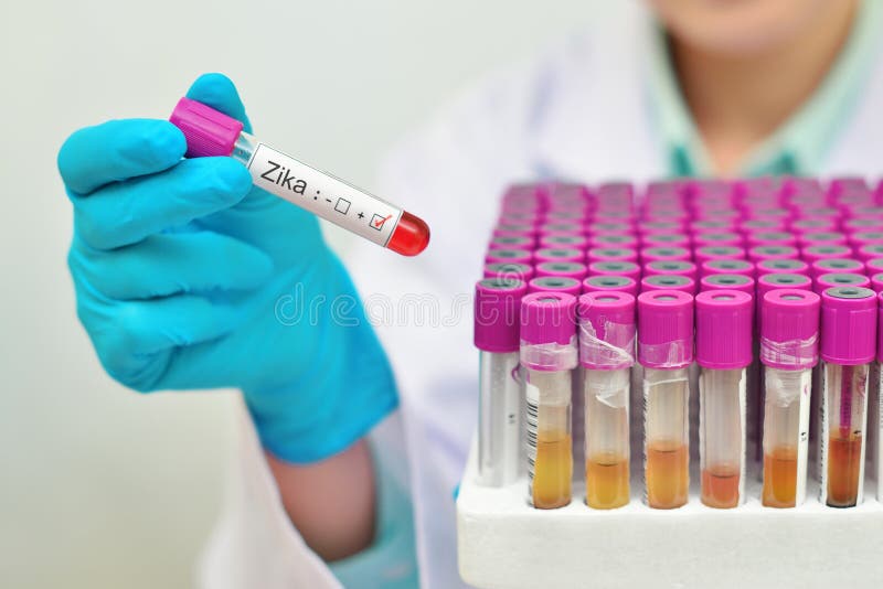Zika-Viruspositiv lizenzfreies stockbild Zika-Viruspositiv lizenzfreies stockbild