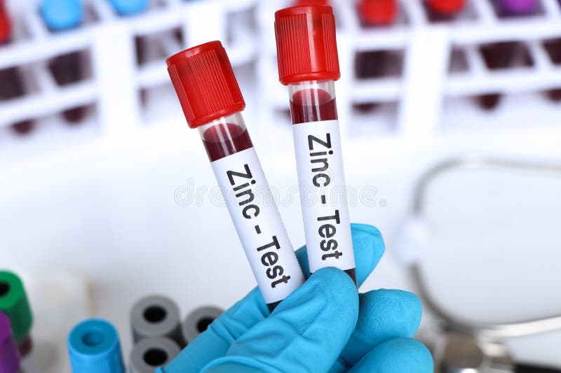Zinc Test, Blood Sample To Analyze in the Laboratory Stock Image