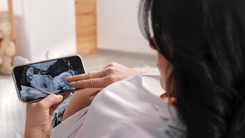 Zwangere vrouw met een buikuitziende digitale röntgenbaby roentgen scan diagnostisch gebruik smartphone