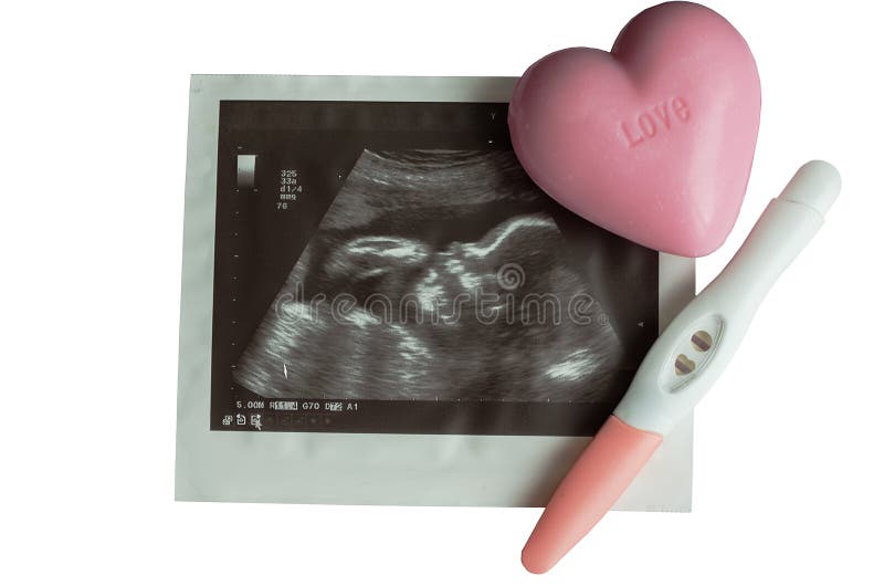 Zwangerschapsconcept met ultrasone klankbeeld van baby stock afbeelding Zwangerschapsconcept met ultrasone klankbeeld van baby stock afbeelding