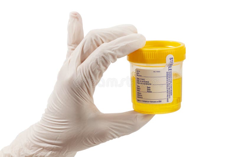 Échantillon d'urine avec le gant