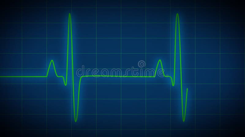 électrocardiogramme de moniteur de coeur
