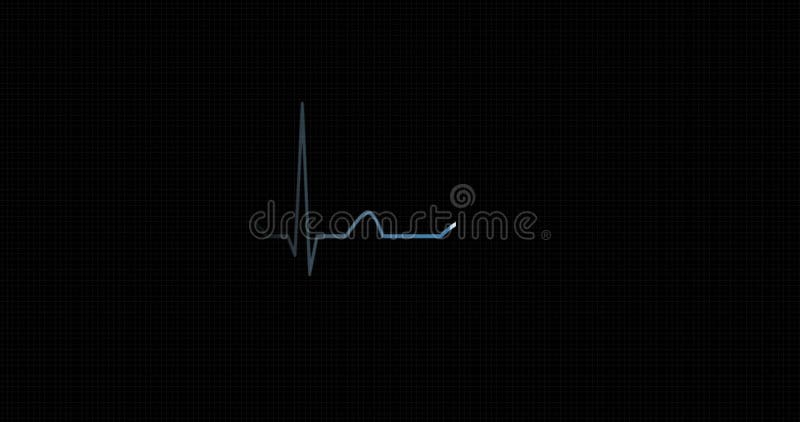 électrocardiogramme de rythme de coeur, ECG Impulsion de battement de coeur