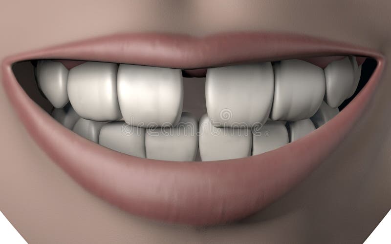 иллюстрация 3d рта женщины вполне сильных белых зубов с улыбкой malocclusion зазора иллюстрация штока