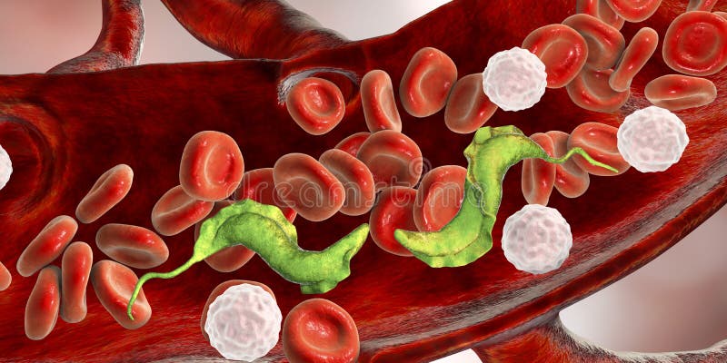 Sobrecrecimiento bacteriano causas Sobrecrecimiento bacteriano causas