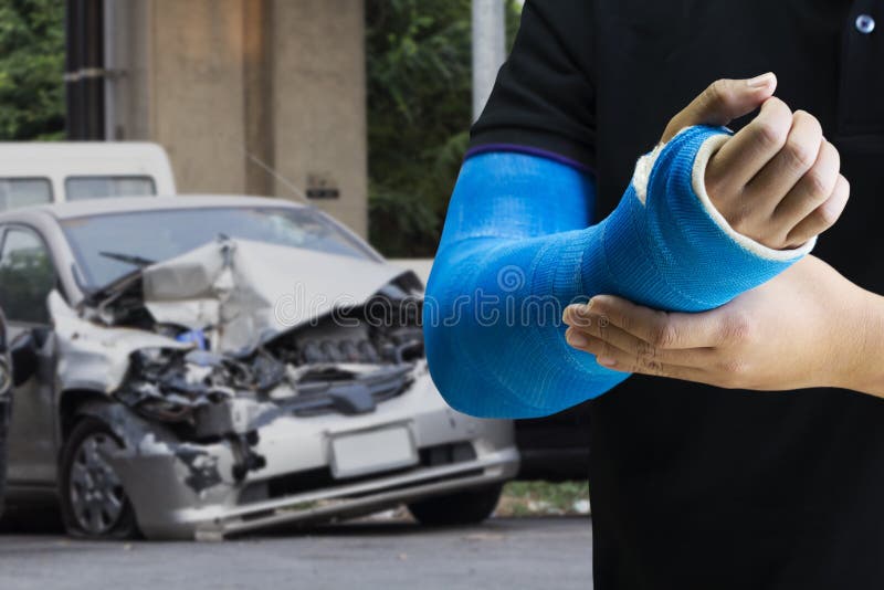 Άνδρας που κρατά χέρι με μπλε επίδεσμο ως τραυματισμός στο χέρι με την ιδέα του αυτοκινητιστικού ατυχήματος στοκ εικόνες με δικαίωμα ελεύθερης χρήσης
