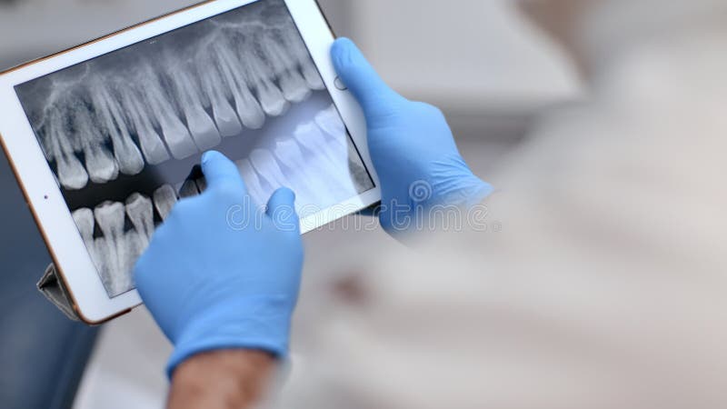 άρρενες οδοντίατροι με προστατευτικά λαστιχένια γάντια εξέταση δόντια ψηφιακό tablet roentgen στην κλινική απόθεμα βίντεο