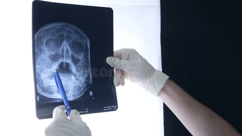 Αρσενικός γιατρός που εξετάζει μια των ακτίνων X εικόνα ενός κεφαλιού