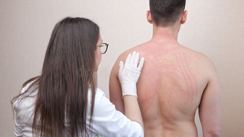 γυναίκα με λευκή ρόμπα εξετάζει ερεθισμένο γυμνό πίσω μέρος ασθενούς φιλμ μικρού μήκους