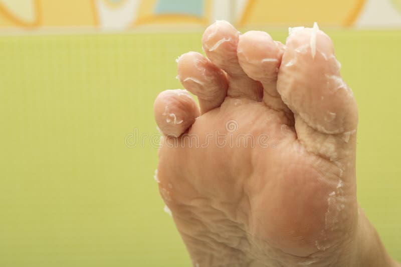 Δέρμα αποφλοίωσης στα toe μιας γυναίκας Ασιατικές μάσκες για το δέρμα των ποδιών, ξεφλούδισμα Η επίδραση της ανανέωσης δερμάτων στοκ φωτογραφίες με δικαίωμα ελεύθερης χρήσης Δέρμα αποφλοίωσης στα toe μιας γυναίκας Ασιατικές μάσκες για το δέρμα των ποδιών, ξεφλούδισμα Η επίδραση της ανανέωσης δερμάτων στοκ φωτογραφίες με δικαίωμα ελεύθερης χρήσης