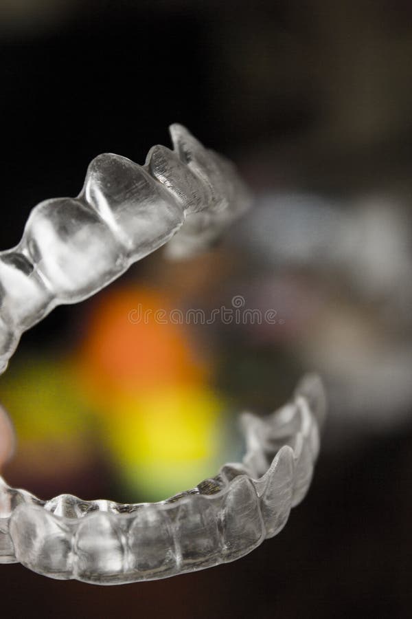 Invisible orthodontics to align the teeth. Invisible orthodontics to align the teeth