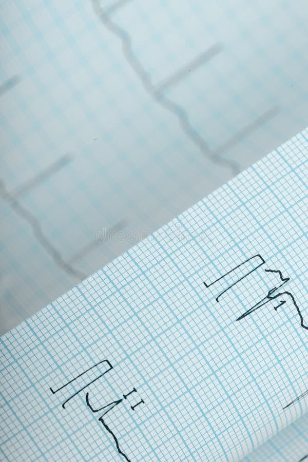 Διπλωμένο υπόβαθρο εγγράφου ECG διάγραμμα στοκ εικόνα Διπλωμένο υπόβαθρο εγγράφου ECG διάγραμμα στοκ εικόνα