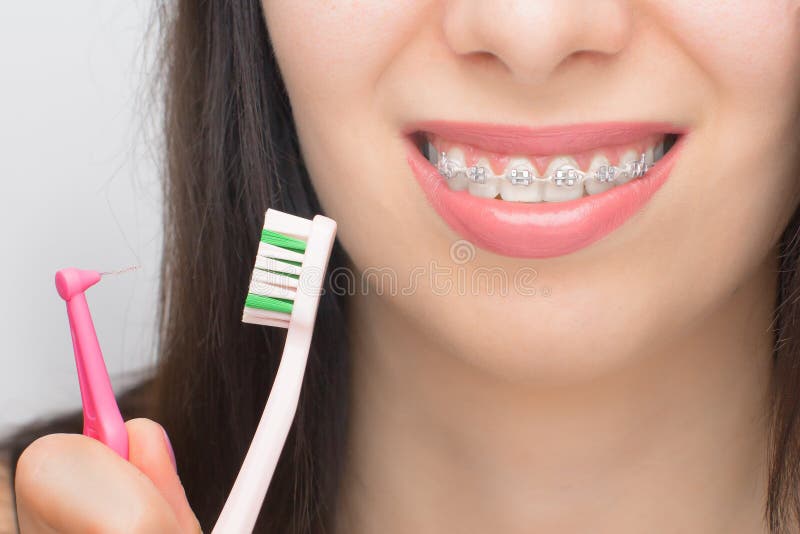 δύο τύποι πινέλου για τον καθαρισμό των δοντιών με οδοντικούς βραχίονες. βραχίονες στα δόντια μετά το τρίψιμο. αγκύλες με μέταλλο