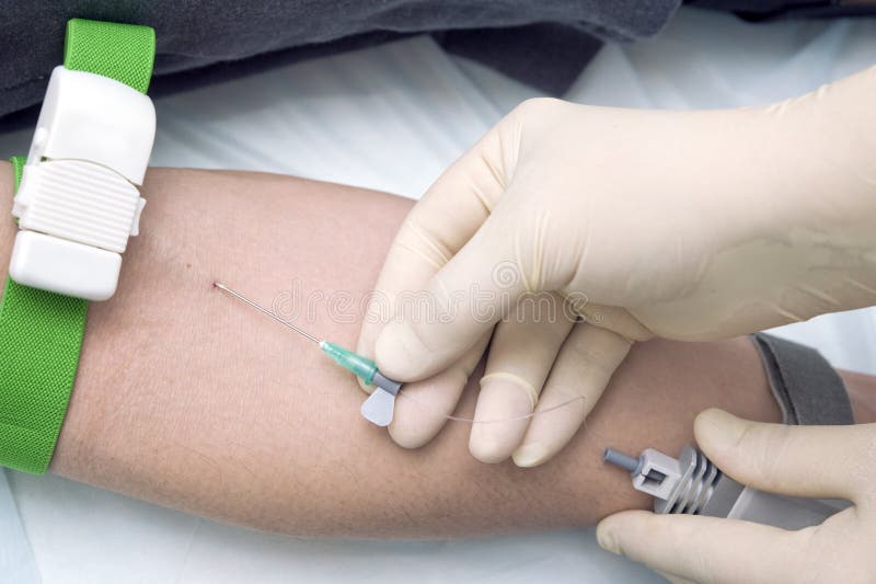 Ενδοφλέβια ακτινοβολία αίματος λέιζερ στοκ φωτογραφίες με δικαίωμα ελεύθερης χρήσης Ενδοφλέβια ακτινοβολία αίματος λέιζερ στοκ φωτογραφίες με δικαίωμα ελεύθερης χρήσης