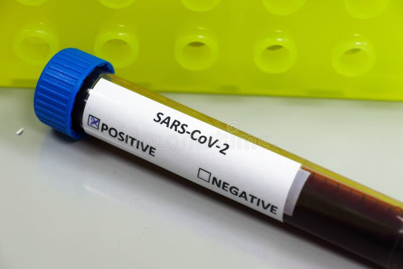 Εξέταση αίματος για COVID- 19 στοκ εικόνες Εξέταση αίματος για COVID- 19 στοκ εικόνες