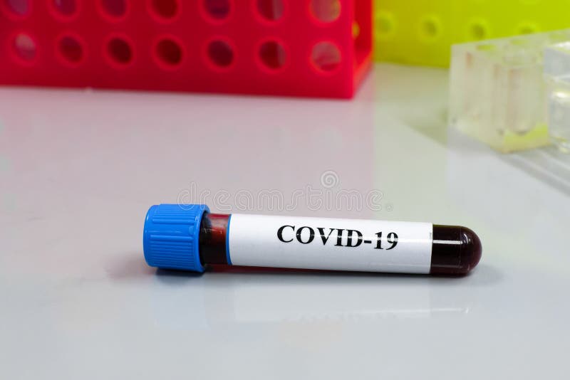 Εξέταση αίματος για COVID- 19 στοκ φωτογραφία με δικαίωμα ελεύθερης χρήσης Εξέταση αίματος για COVID- 19 στοκ φωτογραφία με δικαίωμα ελεύθερης χρήσης
