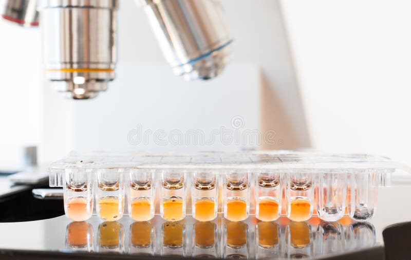 Εξέταση ούρων για candida το μύκητα στο εργαστηριακό μικροσκόπιο στοκ εικόνες Εξέταση ούρων για candida το μύκητα στο εργαστηριακό μικροσκόπιο στοκ εικόνες