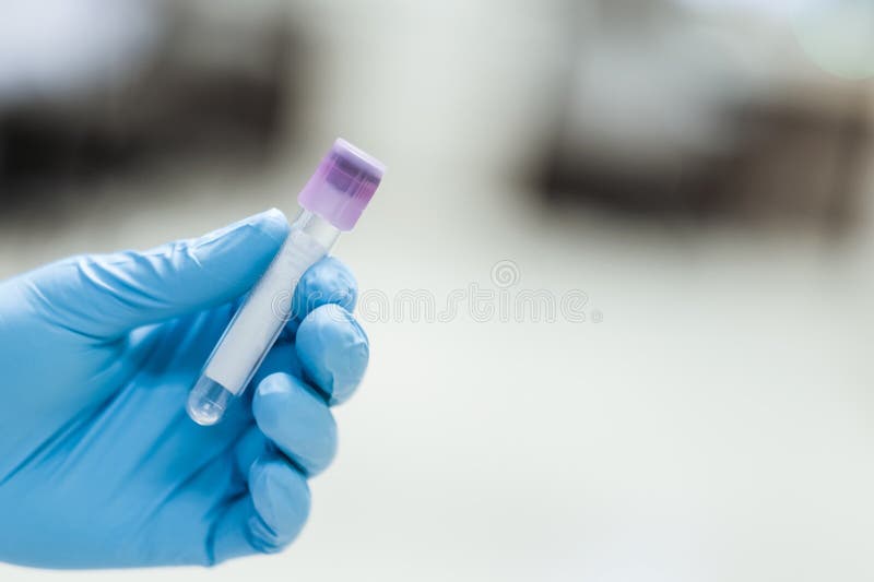 Εργαστηριακός σωλήνας στοκ εικόνες Εργαστηριακός σωλήνας στοκ εικόνες