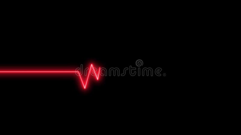 η παρακολούθηση καρδιακών παλμών ekg δείχνει καρδιακό θρόμβο χωρίς διακοπή, ηλεκτροκαρδιογράφημα ελεύθερη απεικόνιση δικαιώματος