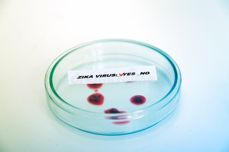 Θετικό δειγμάτων αίματος με τον ιό Zika στοκ εικόνα Θετικό δειγμάτων αίματος με τον ιό Zika στοκ εικόνα