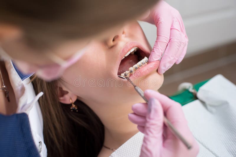 Θηλυκός οδοντίατρος που ελέγχει επάνω τα υπομονετικά δόντια με τα υποστηρίγματα μετάλλων στο οδοντικό γραφείο κλινικών Ιατρική, ο
