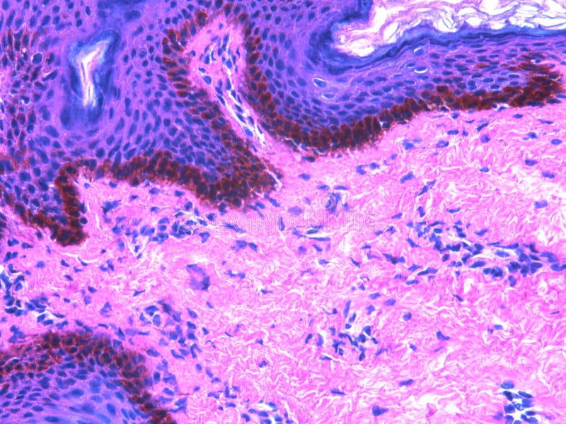 This is human skin stained with hematoxylin (purple) and eosin (pink) also called H&E. From top, the blue with round nuclei is the epidermis (keratin). The brownish black strip before the pink is melanin. All the roundish purple circles are nuclei. The pink is muscle and collagen. This is human skin stained with hematoxylin (purple) and eosin (pink) also called H&E. From top, the blue with round nuclei is the epidermis (keratin). The brownish black strip before the pink is melanin. All the roundish purple circles are nuclei. The pink is muscle and collagen.