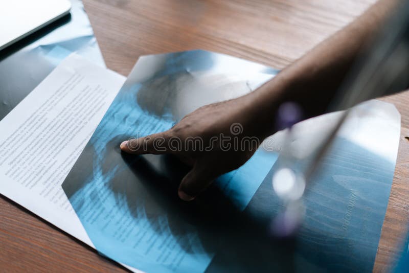 κλειστό χέρι του αγνώστου αφροαμερικανού γιατρού που δείχνει με δείκτη την ακτινογραφική ακτινογραφία των πνευμόνων. στοκ εικόνα