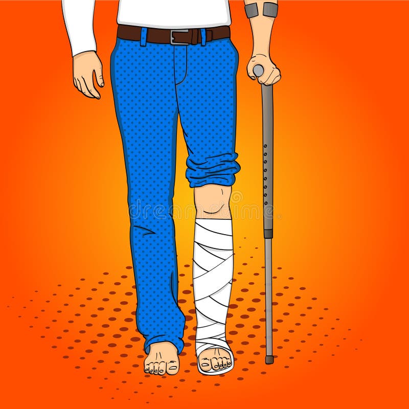 Pop art men legs in plaster, cane and support. Rehabilitation means. Vector illustration, imitation comic style. Pop art men legs in plaster, cane and support. Rehabilitation means. Vector illustration, imitation comic style.