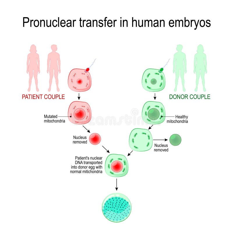 Babies of three-parent. inherited mitochondrial diseases. Pronuclear transfer in human embryos. Vector diagram for educational, medical, biological and science use. Babies of three-parent. inherited mitochondrial diseases. Pronuclear transfer in human embryos. Vector diagram for educational, medical, biological and science use