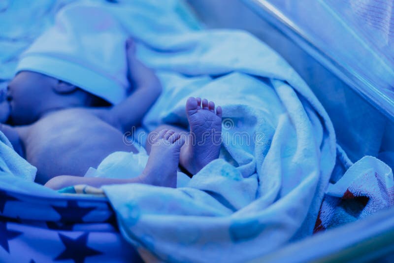 νεογέννητος να βρεθεί μωρών κάτω από τον μπλε λαμπτήρα λόγω bilirubin, phototherapy, έχει τον ίκτερο στοκ φωτογραφία με δικαίωμα ελεύθερης χρήσης νεογέννητος να βρεθεί μωρών κάτω από τον μπλε λαμπτήρα λόγω bilirubin, phototherapy, έχει τον ίκτερο στοκ φωτογραφία με δικαίωμα ελεύθερης χρήσης