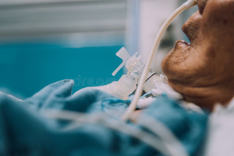 Ο ασθενής κάνει το tracheostomy και τον εξαεριστήρα στο νοσοκομείο στοκ εικόνες Ο ασθενής κάνει το tracheostomy και τον εξαεριστήρα στο νοσοκομείο στοκ εικόνες