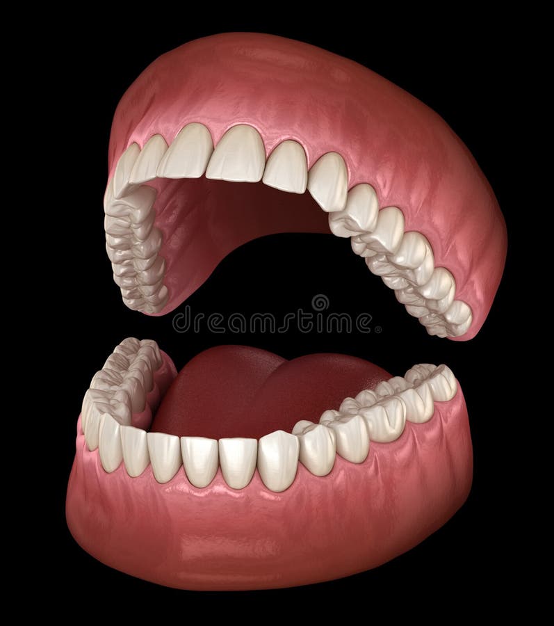 Dental anatomy - Opened Dentures. Medically accurate dental 3D illustration. Dental anatomy - Opened Dentures. Medically accurate dental 3D illustration