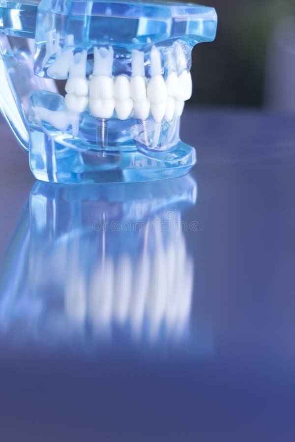 Οδοντικό πρότυπο δοντιών Dentsts στοκ φωτογραφίες με δικαίωμα ελεύθερης χρήσης Οδοντικό πρότυπο δοντιών Dentsts στοκ φωτογραφίες με δικαίωμα ελεύθερης χρήσης