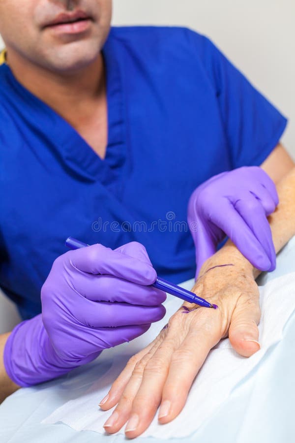 Πλαστικός γιατρός χειρούργων που χαρακτηρίζει το χέρι της ανώτερης γυναίκας για τη χειρουργική επέμβαση στοκ φωτογραφία Πλαστικός γιατρός χειρούργων που χαρακτηρίζει το χέρι της ανώτερης γυναίκας για τη χειρουργική επέμβαση στοκ φωτογραφία