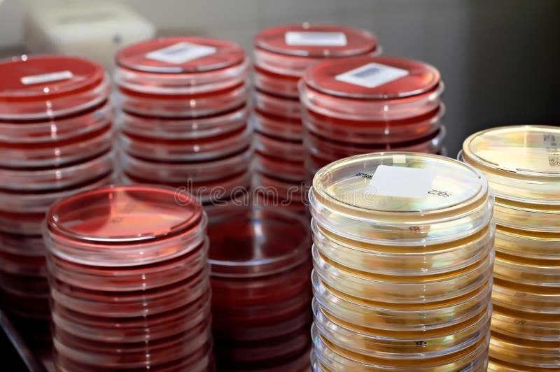 A compilation of plates with culture medium stored in a laboratory. A compilation of plates with culture medium stored in a laboratory