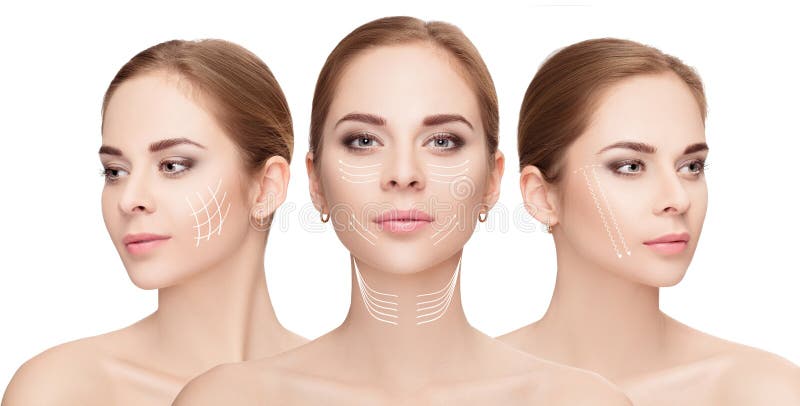 woman faces with arrows over white background. Face lifting concept. Plastic surgery treatment, medicine. woman faces with arrows over white background. Face lifting concept. Plastic surgery treatment, medicine