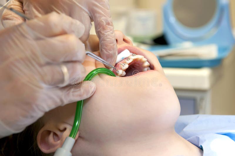 Στηρίγματα στοκ εικόνες Στηρίγματα στοκ εικόνες