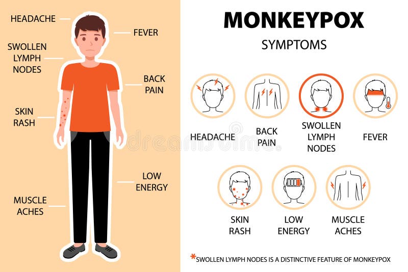 τα συμπτώματα του ιού της ευλογιάς από το monkeypox εμφανίζονται με το άτομο. πονοκέφαλος πόνος στην πλάτη. νέα κρούσματα επιδημία. κεφαλαλγία οσφυαλγία πρήξιμο λεμφαδένες πυρετός δερματικό εξάνθημα κτλ. νέα κρούσματα επιδημίας στην ευρώπη και τις ηπα. απομονωμένη απεικόνιση κινούμενων σχεδίων διανυσμάτων.