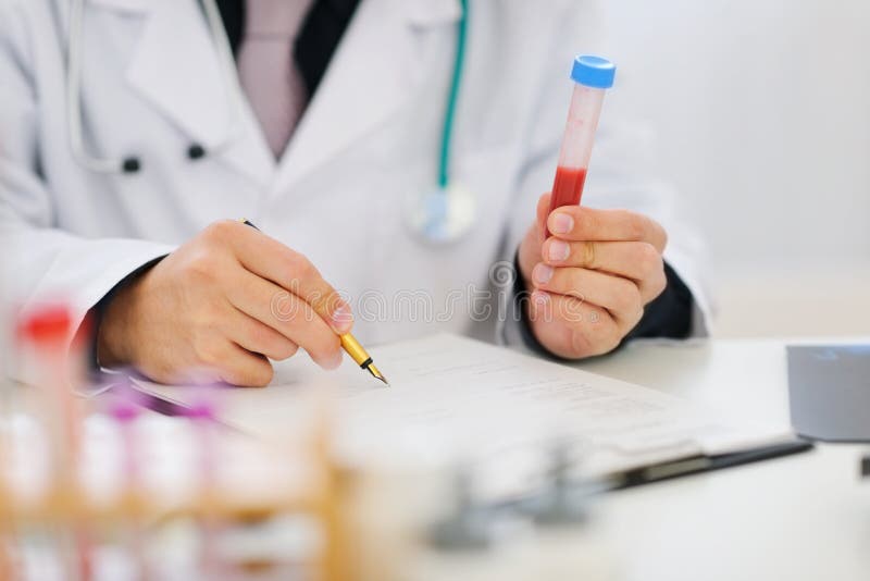 χέρια γιατρών κινηματογραφήσεων σε πρώτο πλάνο αίματος που κρατούν το δείγμα στοκ φωτογραφία με δικαίωμα ελεύθερης χρήσης χέρια γιατρών κινηματογραφήσεων σε πρώτο πλάνο αίματος που κρατούν το δείγμα στοκ φωτογραφία με δικαίωμα ελεύθερης χρήσης
