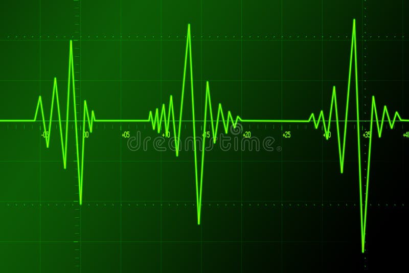Digital pulse on a green/black gradient background. Digital pulse on a green/black gradient background