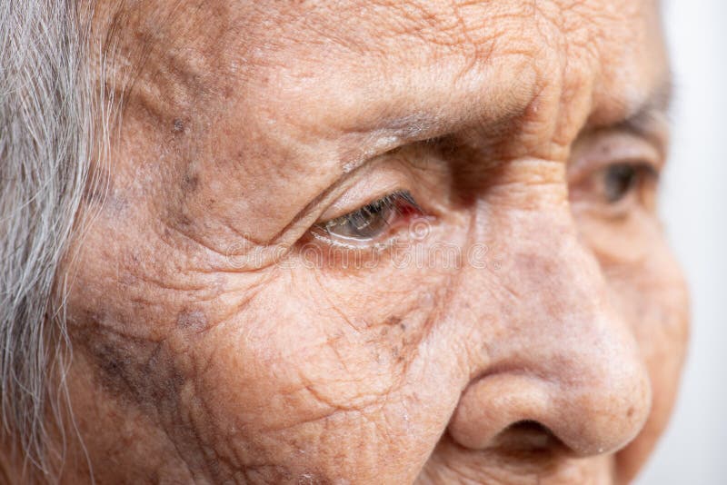 Валка старухи сиротливая слабоумие и заболевание Alzheimer’s стоковая фотография