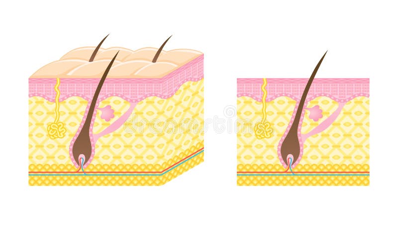 Diagram of a hair follicle. Diagram of a hair follicle.