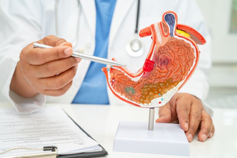 Stomach disease, doctor with anatomy model for study diagnosis and treatment. Stomach disease, doctor with anatomy model for study diagnosis and treatment