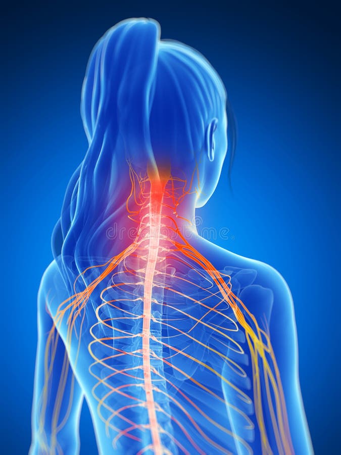 3d rendered illustration of a painful neck. 3d rendered illustration of a painful neck