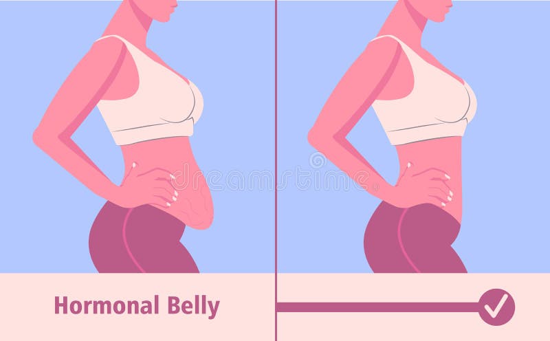 Tipos de barriga mujer hormonal