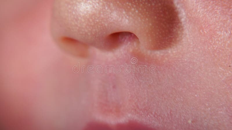 Кандидоз (молочница) полости рта у грудных детей